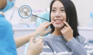 Get A Confident & Healthy Smile With Dental Implants Near Tri-Valley