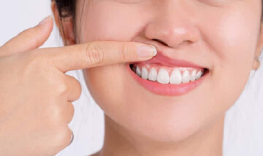 gum disease treatment