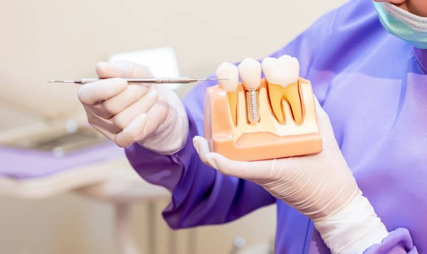 Dental Implants vs. Dentures