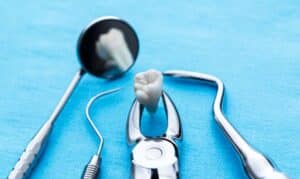 Will a dentist pull an infected tooth the same day?