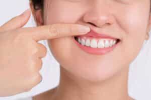 How to reverse periodontal disease naturally?