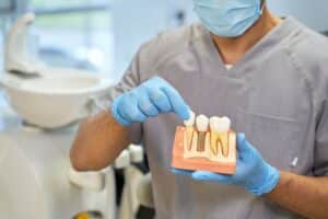 All on 4 Dental Implants Livermore