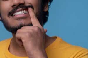 Periodontal Maintenance Livermore