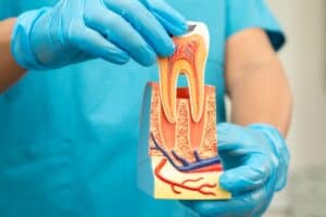 Root Canal Treatment in Livermore