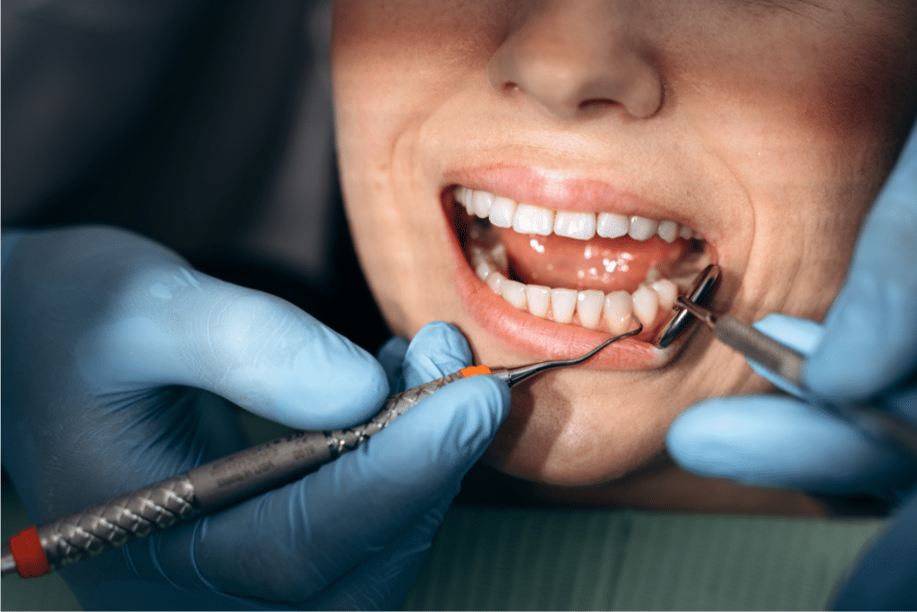 dentist livermore ca