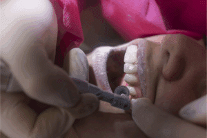 dentist in Livermore