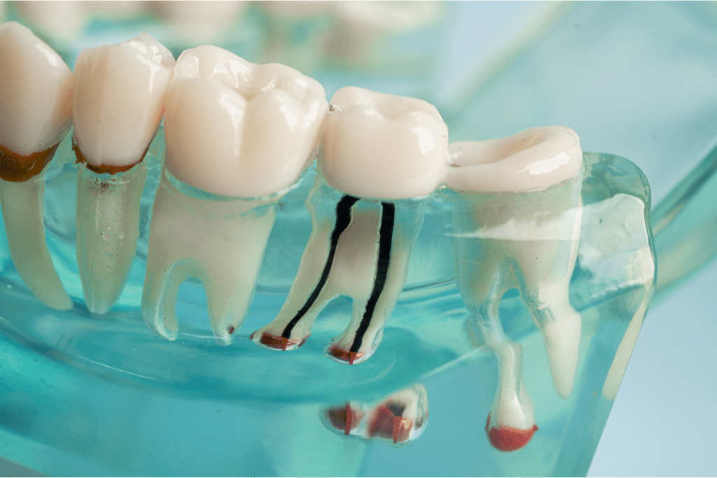 dental implants in Livermore