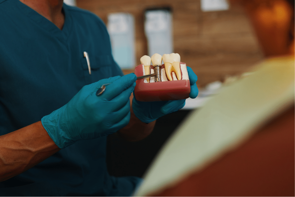 dental implants in Livermore CA