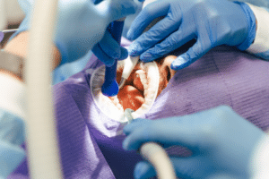 periodontist near me in Livermore