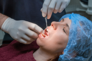 dental implants in Livermore