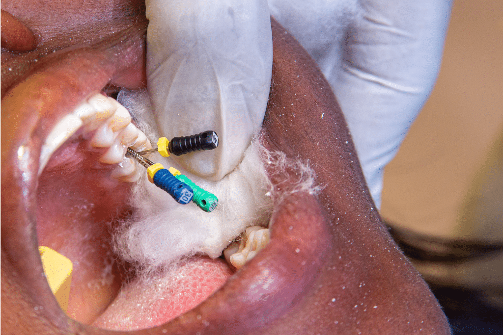 Endodontist Near Me in Livermore